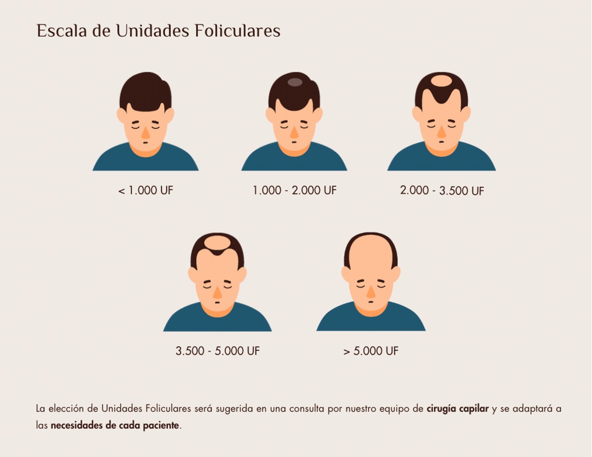 precio-trasplante